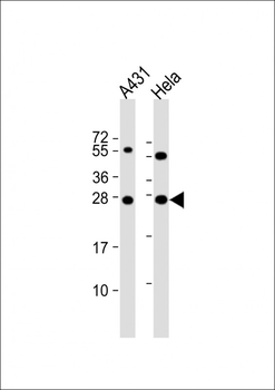 PSPH Antibody (N-term)