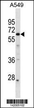 GPR107 Antibody (C-term)