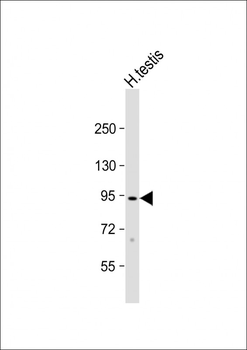 CTAGE1 Antibody (Center)