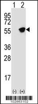 GFAP Antibody (C-term)