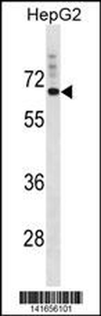 SVOP Antibody (N-term)