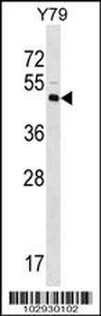 XLKD1 Antibody (N-term)