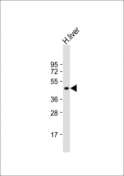 XLKD1 Antibody (N-term)