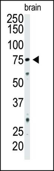 CD73 (NT5E) Antibody (C-term)