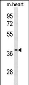 VSIG2 Antibody (C-term)