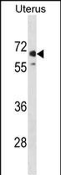 MMEL1 Antibody (N-term)