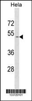 SMAD1 Antibody (N-term)