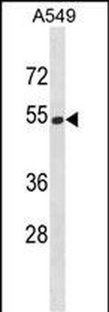 HERPUD2 Antibody (C-term)