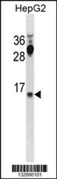 CYYR1 Antibody (C-term)