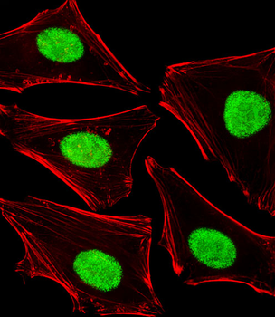 POLDIP3 Antibody (N-term)