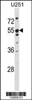 KRT86 Antibody (Center)