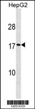 SEC11A Antibody (Center)