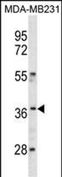 HOXC10 Antibody (C-term)