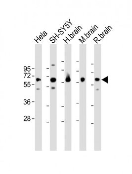 GDI1 Antibody (C-term)
