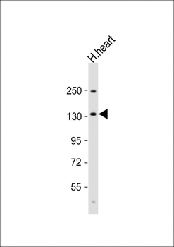 BMPR2 Antibody (N-term)