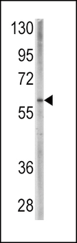 BMPR1A Antibody (C-term)