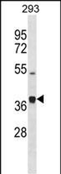 PCOLCE2 Antibody (Center)