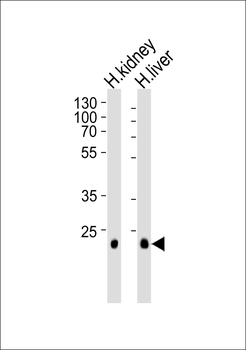 CLDN14 Antibody (C-term)