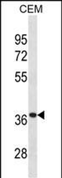 TTPA Antibody (Center)