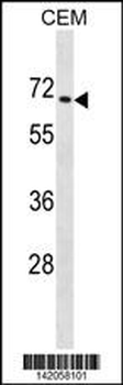 ZNF93 Antibody (N-term)