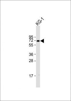 ZNF93 Antibody (N-term)