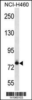 FCRL3 Antibody (C-term)