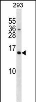 SH2D1A Antibody (C-term)