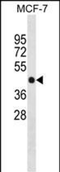 PPM1F Antibody (Center)