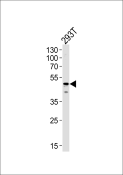 YBX1 Antibody (Center)