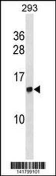 HIST2H2AC Antibody (Center)