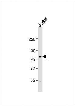 UNC5C Antibody (N-term)