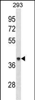 ACAA1 Antibody (Center)