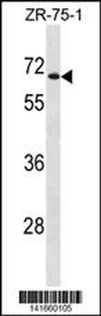 UGT2B28 Antibody(Center)