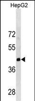 LRRC19 Antibody(C-term)