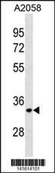 ELOVL3 Antibody(C-term)