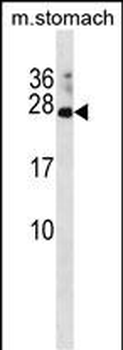 RAP2C Antibody(N-term)