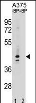 OR5AC2 Antibody(C-term)