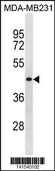 SPRYD5 Antibody(N-term)