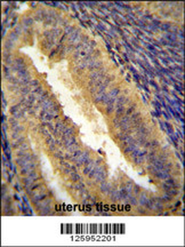 JUN Antibody (C-term)
