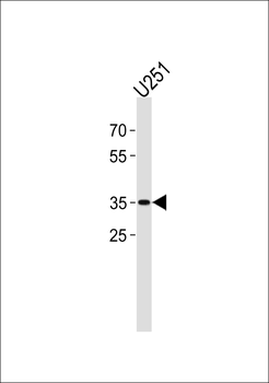 JUN Antibody (C-term)