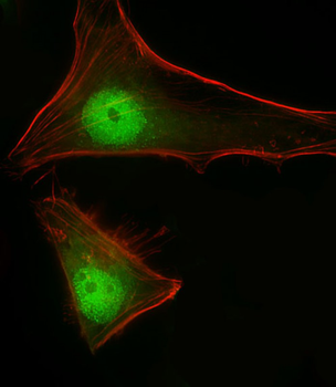STAT1 Antibody (C-term)
