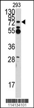 ZNF219 Antibody (N-term)