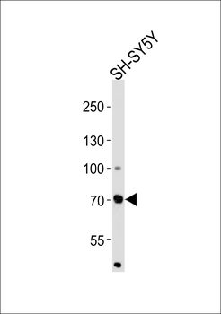 ZNF219 Antibody (N-term)