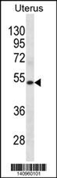 KRT72 Antibody(Center)