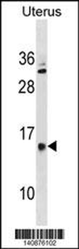 GALNTL5 Antibody(N-term)