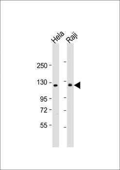 NFKB(p100) Antibody (C-term S866/870)