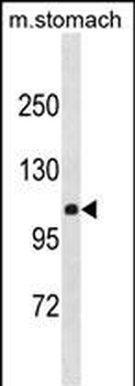 CLSTN2 Antibody(Center)