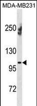 ENPP1 Antibody(N-term)