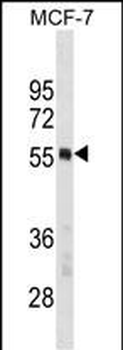 PTBP1 Antibody(N-term)