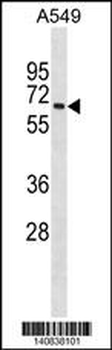 MBOAT7 Antibody(Center)